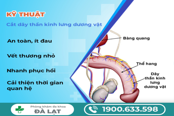 Hình ảnh minh họa